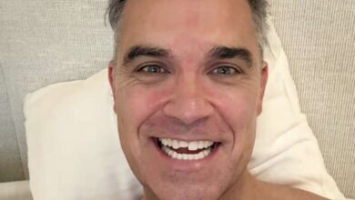 Robbie Williams e il dente mancante, ironia, social e reazioni dei fan
