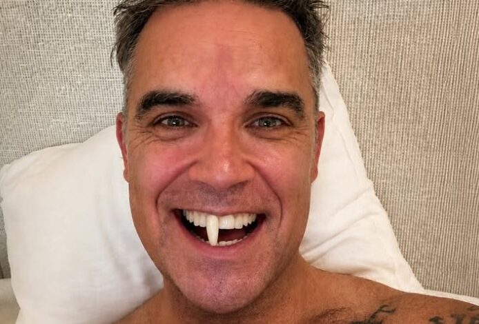 Robbie Williams con il suo nuovo dente rifatto! (ironia)